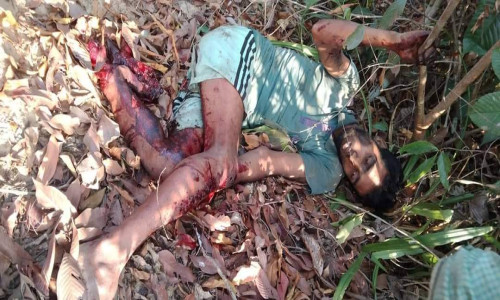 নাইক্ষ্যংছড়ির সীমান্তে মাইন বিস্ফোরণে উড়ে গেছে যুবকের বাম পা