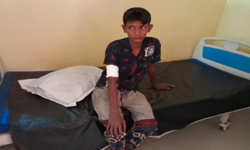 লংগদুতে বন্য শুকরের আক্রমণে আহত তিন